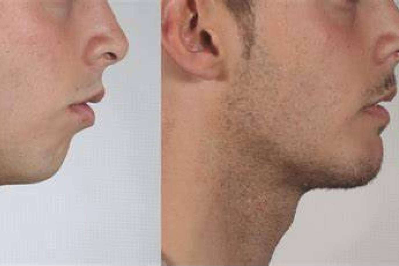 La Clínica Calvo de Mora es una clínica maxilofacial experta en cirugías ortognáticas