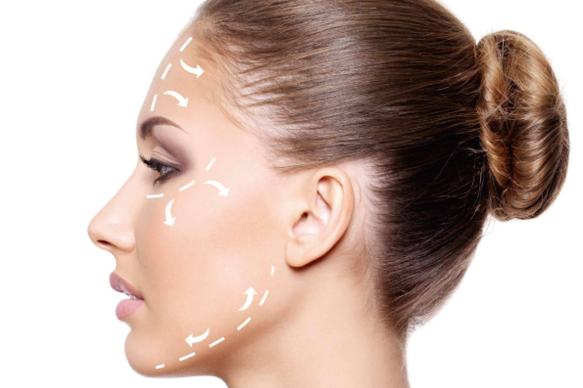 I-FACE esthetic es el lifting facial sin cirugía, rápido y natural