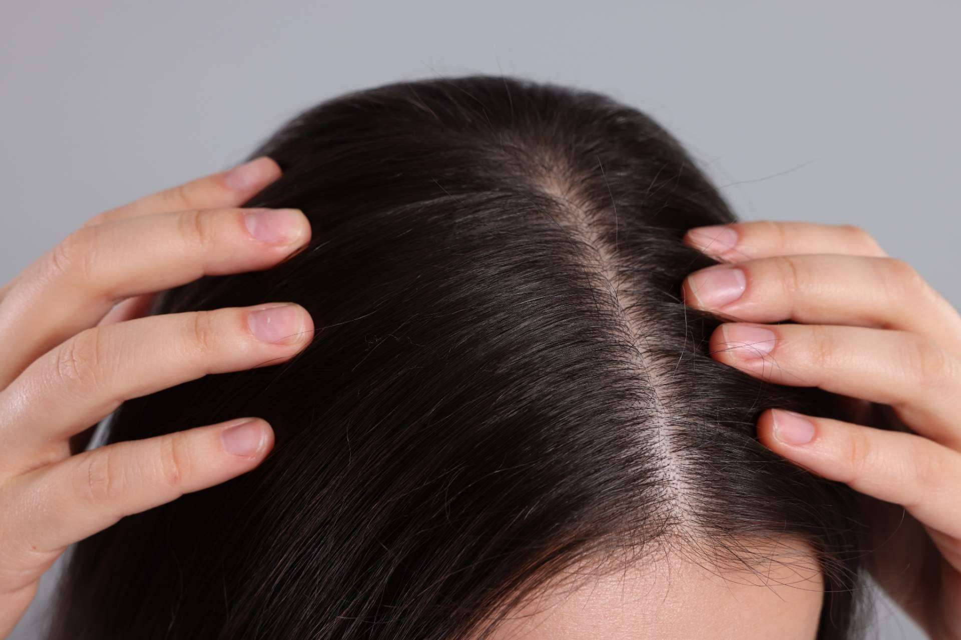 Pelo sin caspa y... ¿bonito? ¡Es posible!